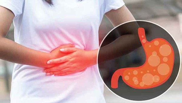 Asam lambung-1634120736